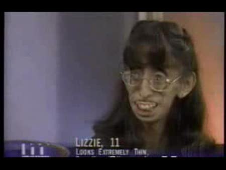 La chica más fea del mundo